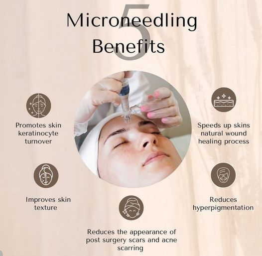 Microneedling