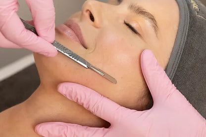 Dermaplaning