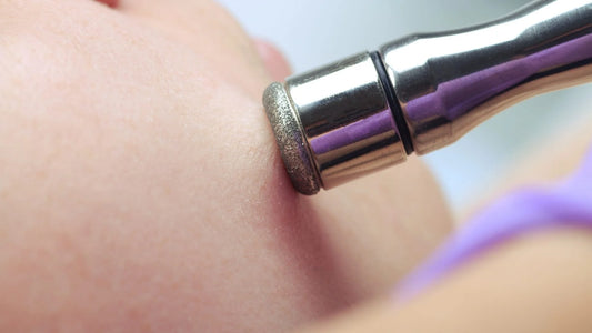 Microdermabrasion